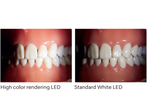 La visibilidad ha mejorado significativamente con la luz LED a color de alta resolución